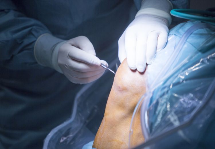 Saiba como funciona os procedimentos sobre artroscopia do ombrio