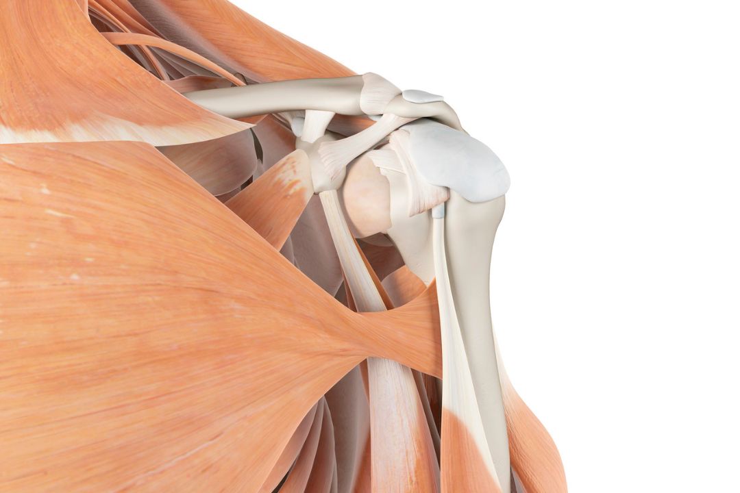 Entenda os motivos e razões para que se deva ocorrer o tratamento cirúrgico para colocação de prótese no ombro. 